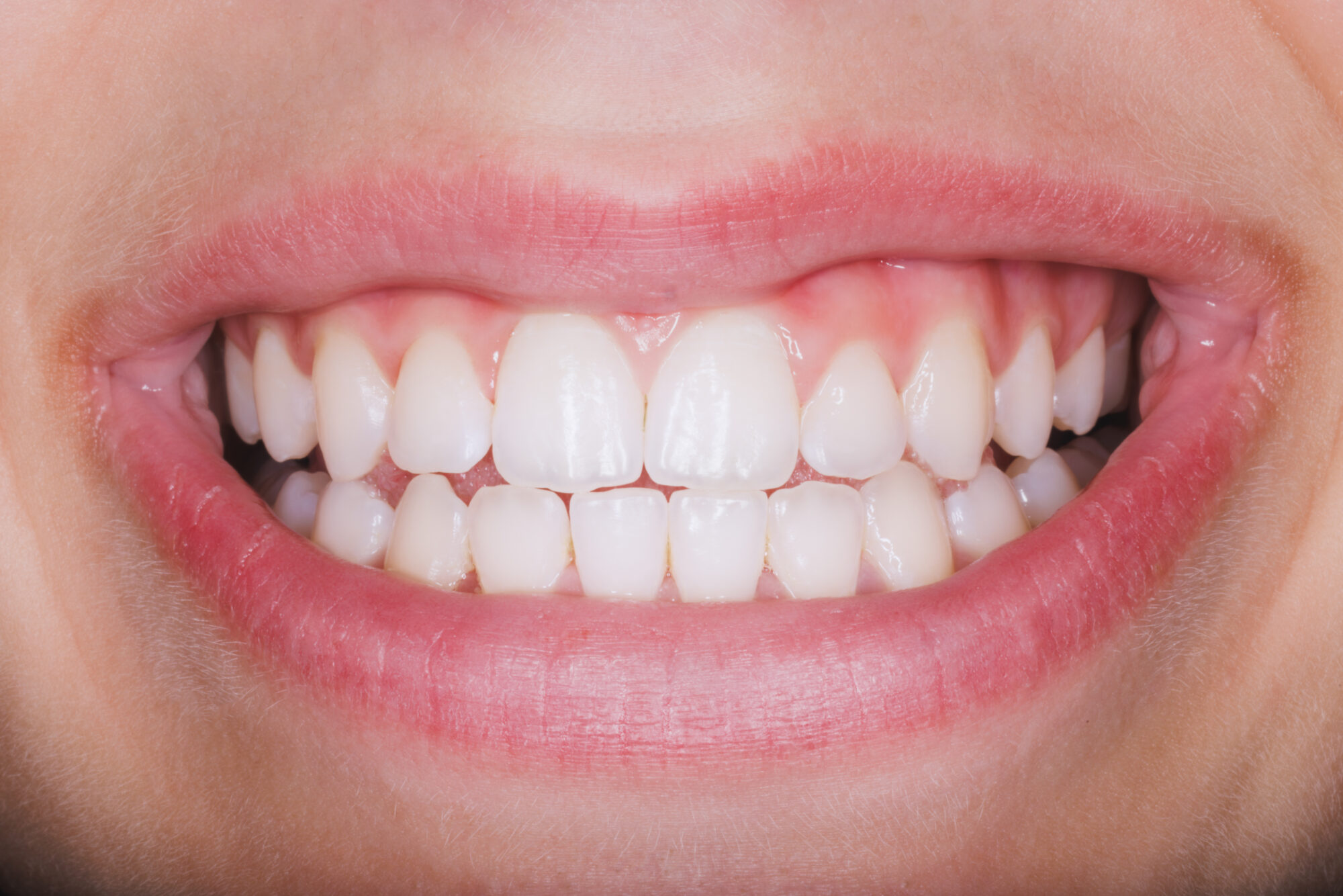 plantation family dentistry